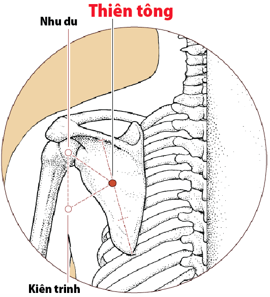 nhung-cach-chua-nac-don-gian-ma-de-dang-6